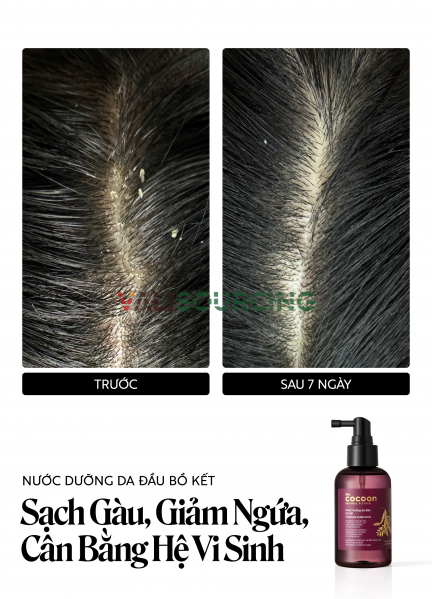 140ml Soapberry Hair Toner from Vietnam
